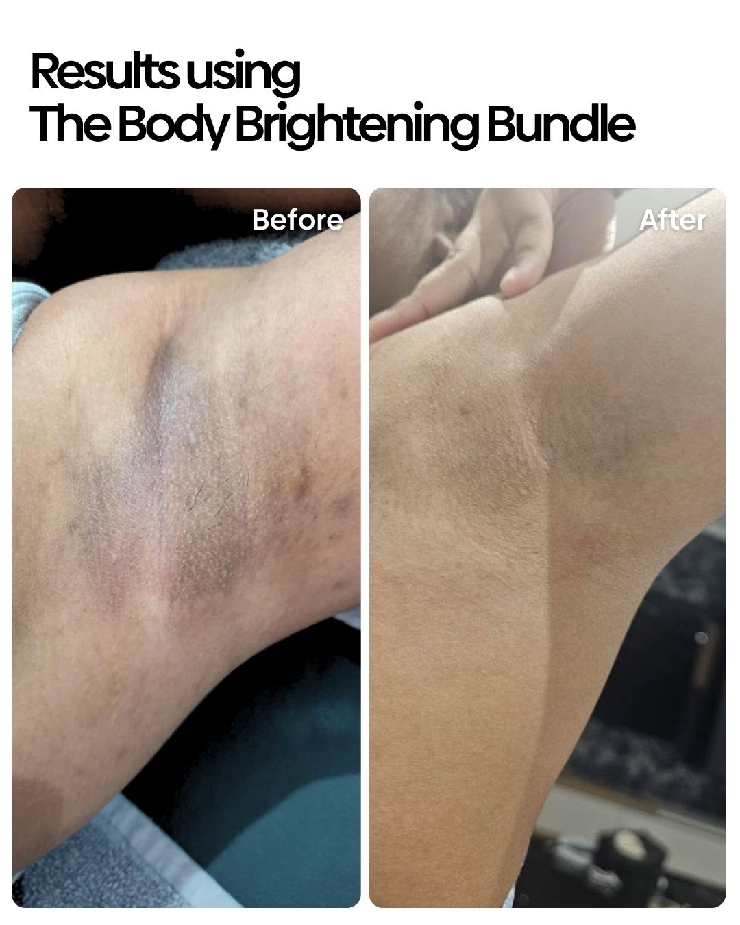 Body Brightening Bundle