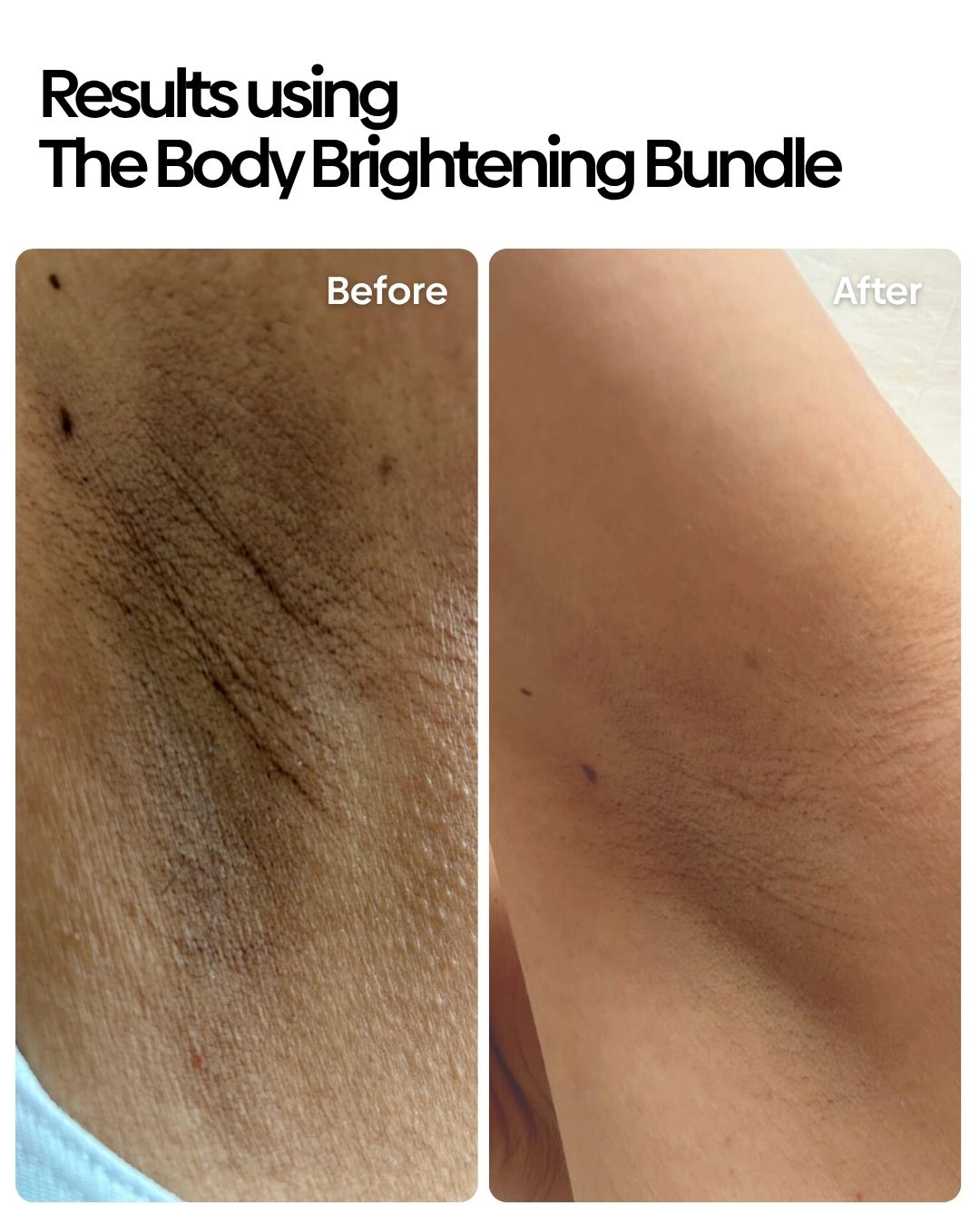 Body Brightening Bundle